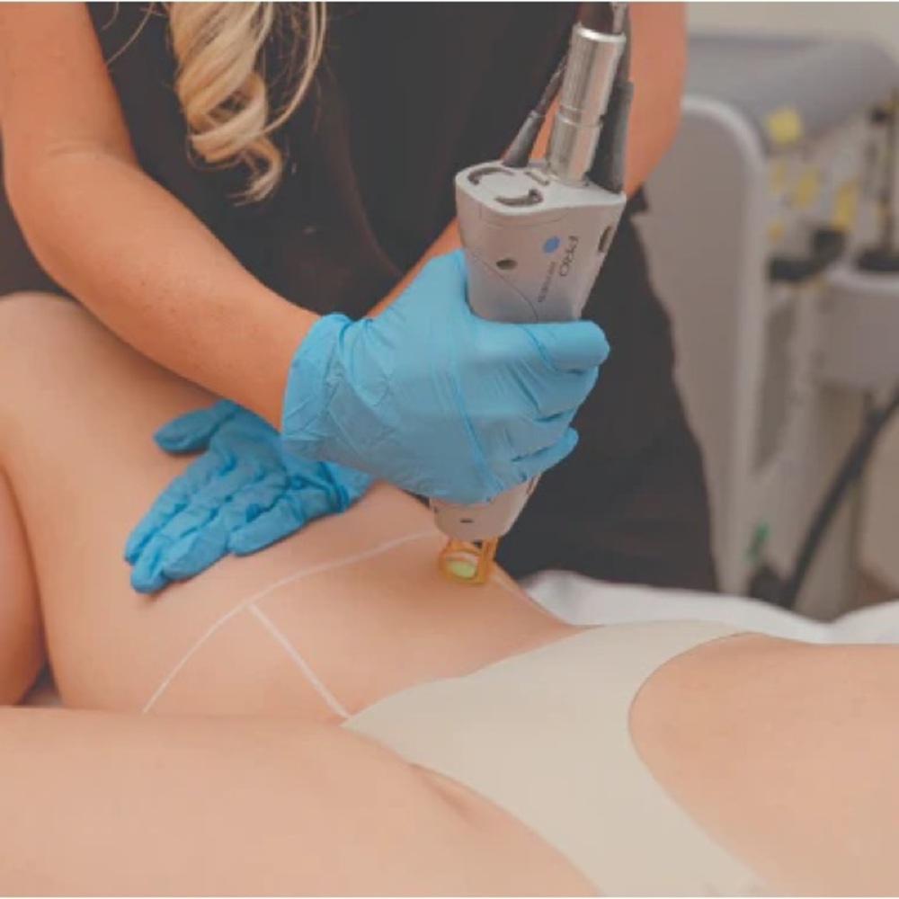 Satori Laser Hair Removal Singles or Packages - Transferrable